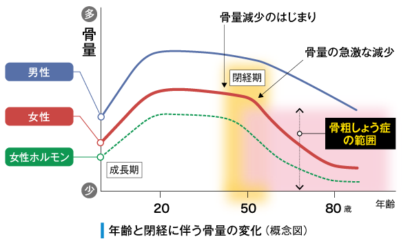 年齢と閉経に伴う骨量の変化（概念図）Image